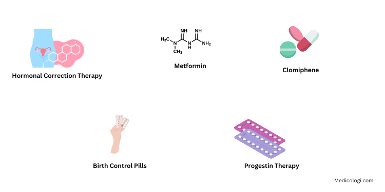 Treatment PCOS