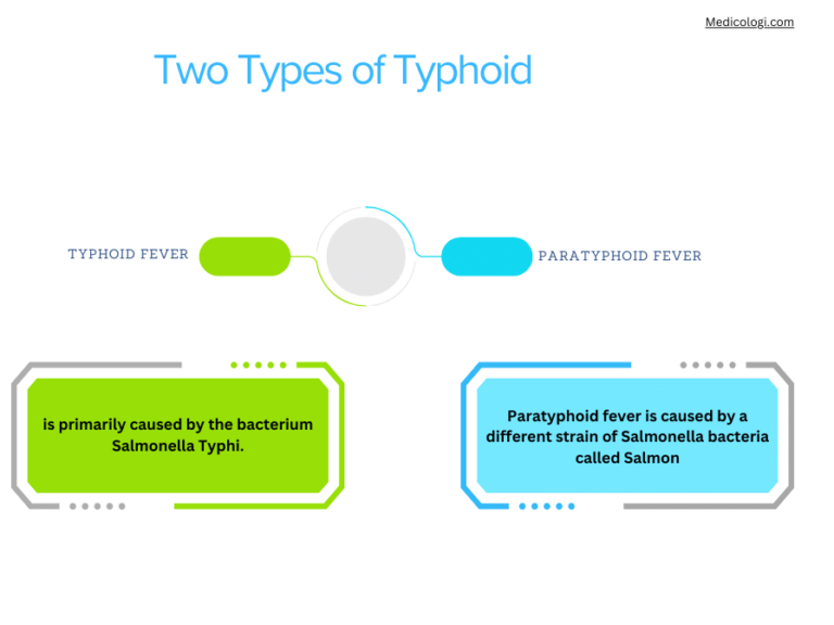 Typhoid Fever Type PPT